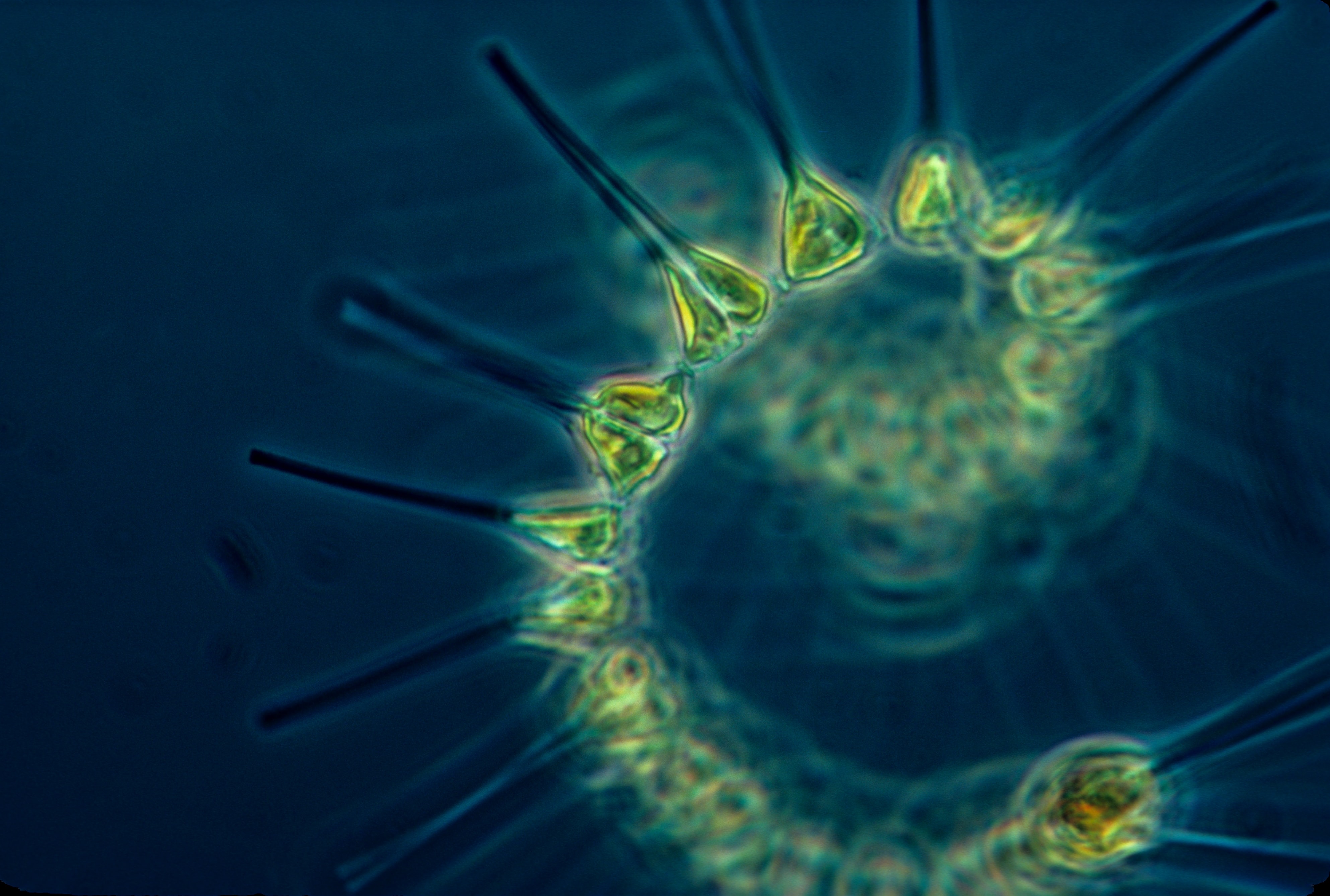 Phytoplankton | MIT Climate Portal