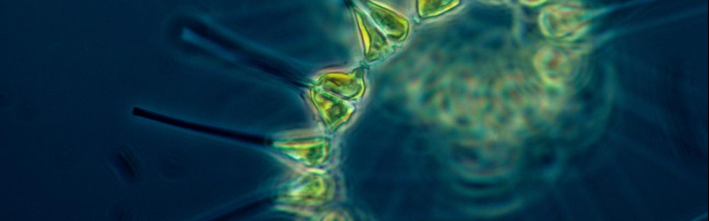 Phytoplankton under a microscope