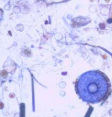 Phytoplankton on microscope slide